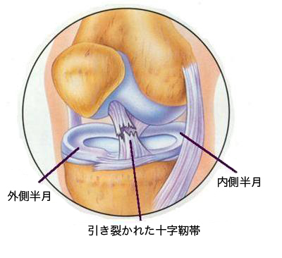 膝関節の構造